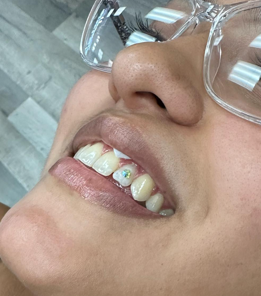Tooth gem smile closeup at Darkstar Tattoo Riverside CA